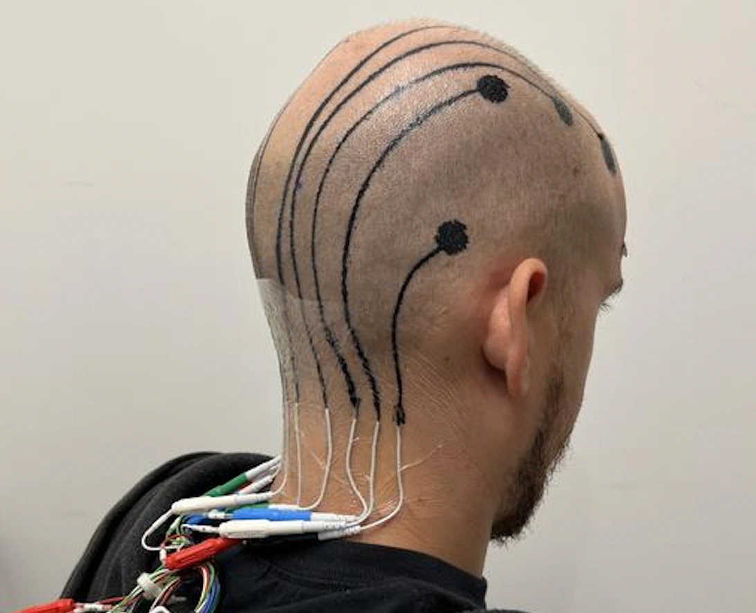 Nuevos E-Tatuajes para Reemplazar los Sistemas EEG Tradicionales