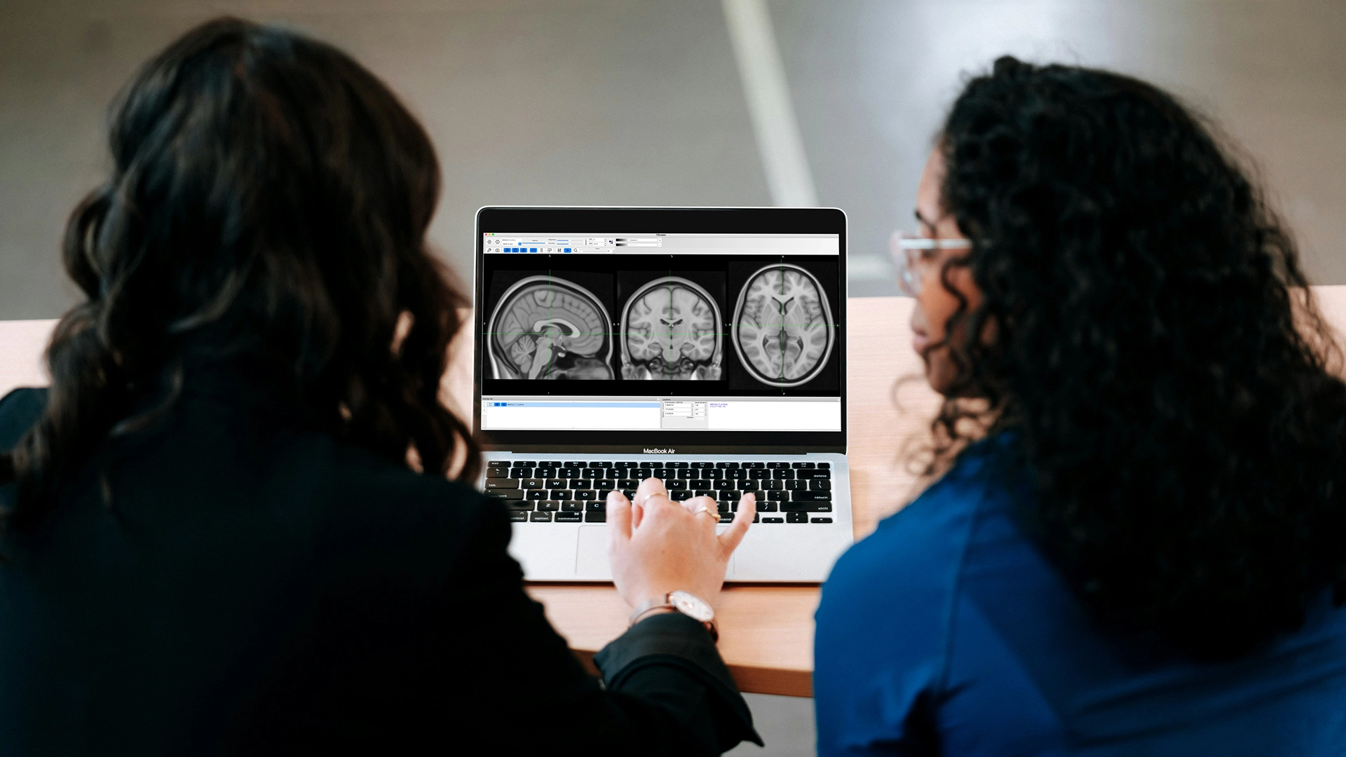 El Nuevo Sistema de IA del MIT Hace la Segmentaci&oacute;n de Im&aacute;genes M&aacute;s R&aacute;pida y F&aacute;cil